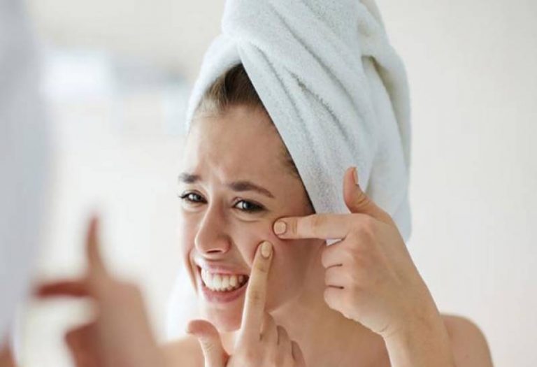 Acne Treatments Tips