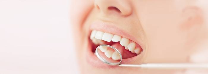 Top Things to Remember While Finding a Dentist in Turkey