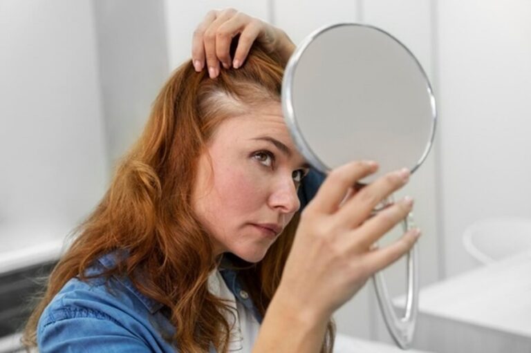 Tips To Avoid Hair Loss after a Weight Loss Surgery