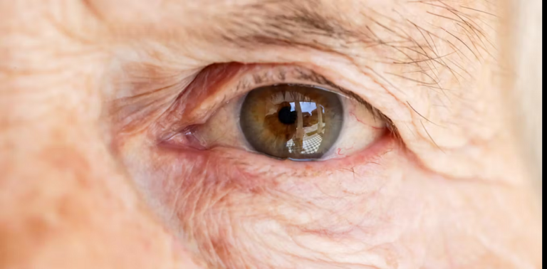Which eye floater formula supports clearer vision naturally?