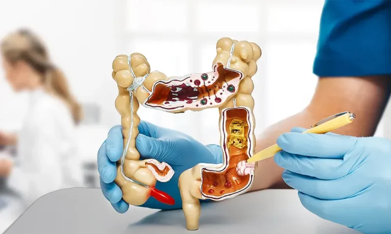 What to expect when planning this important digestive screening step